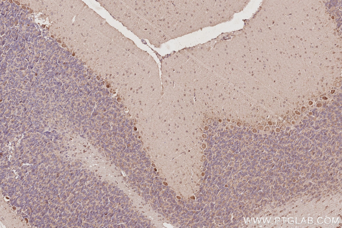 Immunohistochemistry (IHC) staining of rat cerebellum tissue using Plakophilin 3 Polyclonal antibody (18338-1-AP)