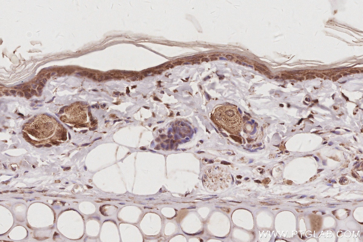 Immunohistochemistry (IHC) staining of rat skin tissue using Plakophilin 3 Polyclonal antibody (18338-1-AP)