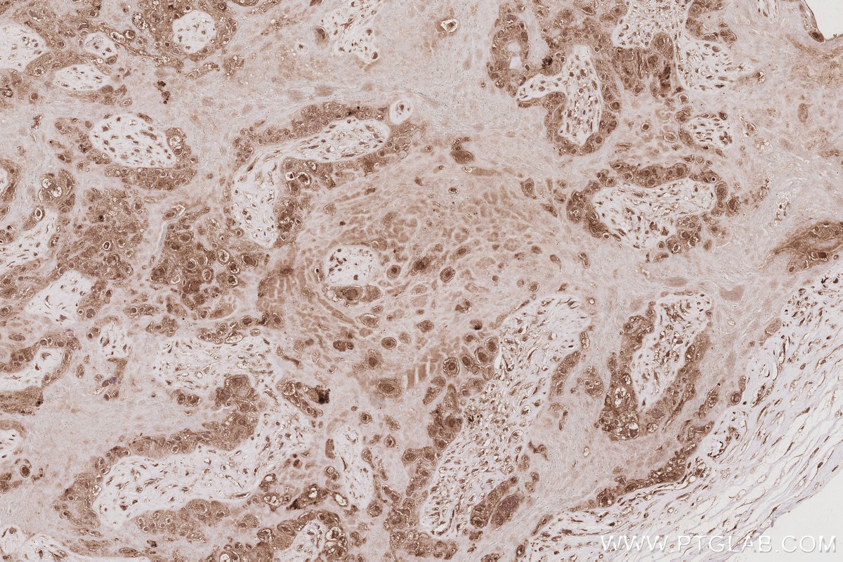 Immunohistochemistry (IHC) staining of human placenta tissue using Plakophilin 3 Polyclonal antibody (18338-1-AP)