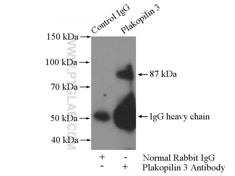 Immunoprecipitation (IP) experiment of A549 cells using Plakophilin 3 Polyclonal antibody (18338-1-AP)