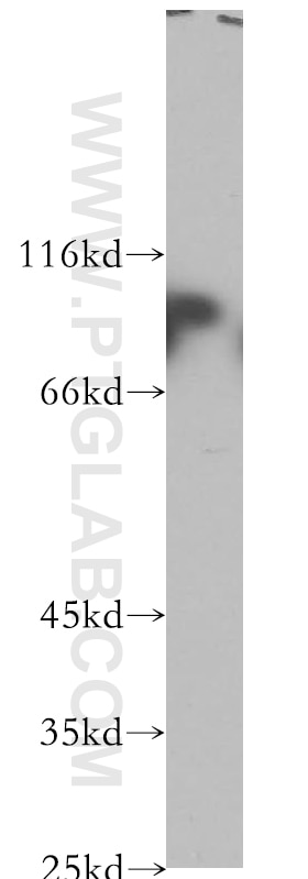 Western Blot (WB) analysis of HeLa cells using Plakophilin 3 Polyclonal antibody (18338-1-AP)