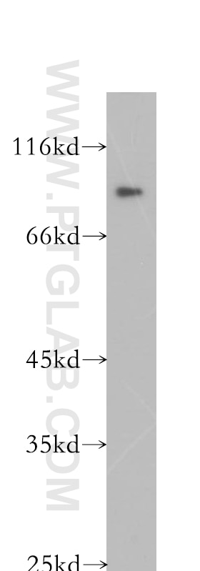 Western Blot (WB) analysis of K-562 cells using Plakophilin 3 Polyclonal antibody (18338-1-AP)