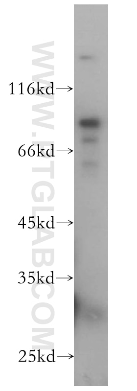 Western Blot (WB) analysis of MCF-7 cells using Plakophilin 3 Polyclonal antibody (18338-1-AP)