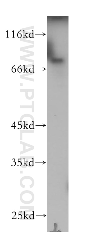 Western Blot (WB) analysis of A549 cells using Plakophilin 3 Polyclonal antibody (18338-1-AP)