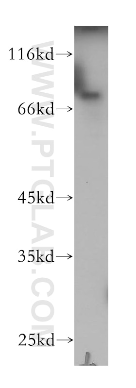 WB analysis of A549 using 18338-1-AP