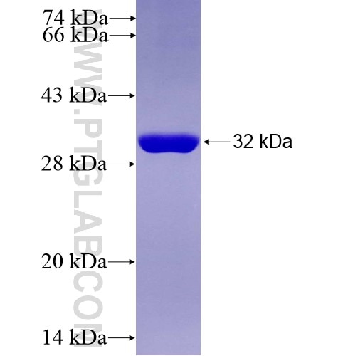 PKP3 fusion protein Ag13062 SDS-PAGE