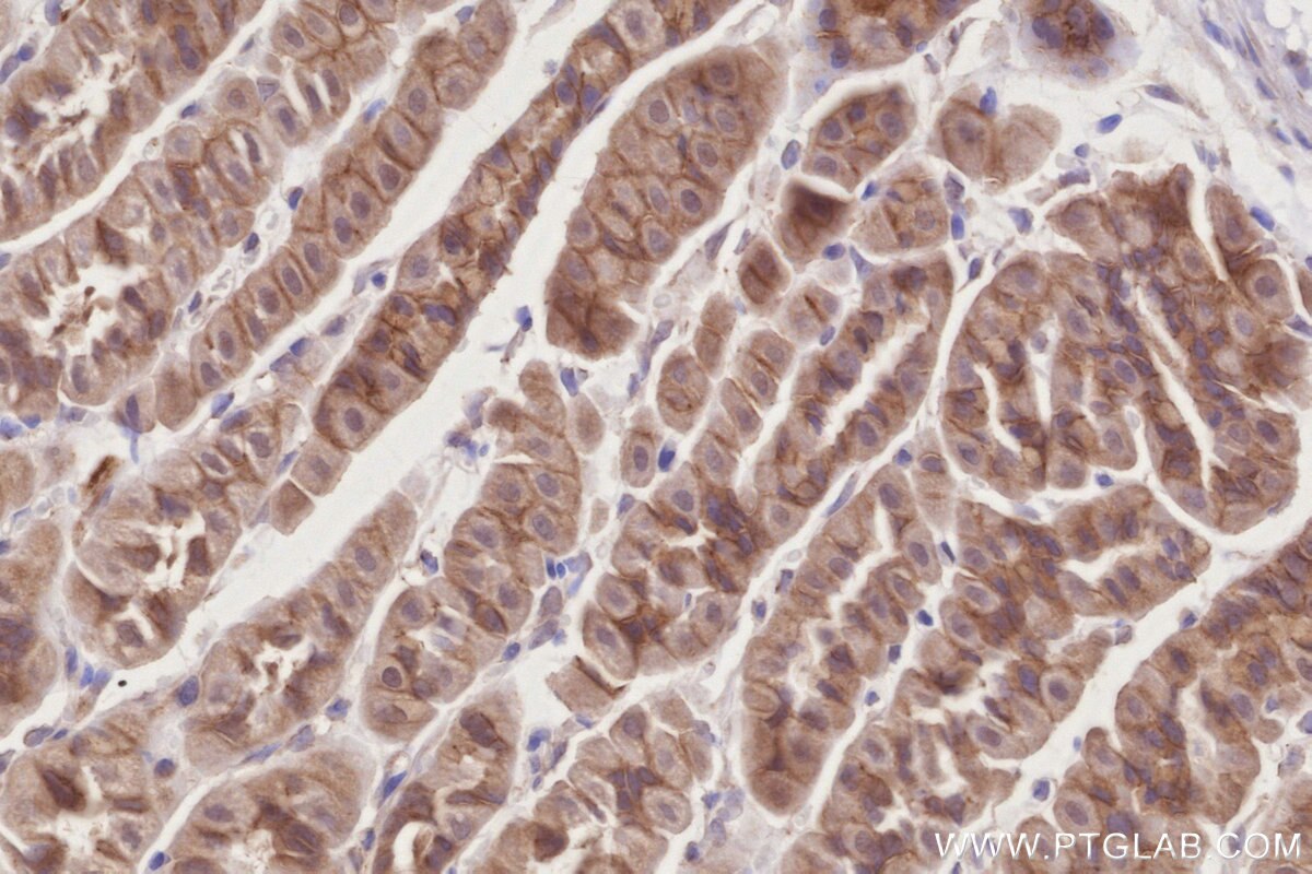 Immunohistochemistry (IHC) staining of mouse stomach tissue using PKP4 Polyclonal antibody (14062-1-AP)