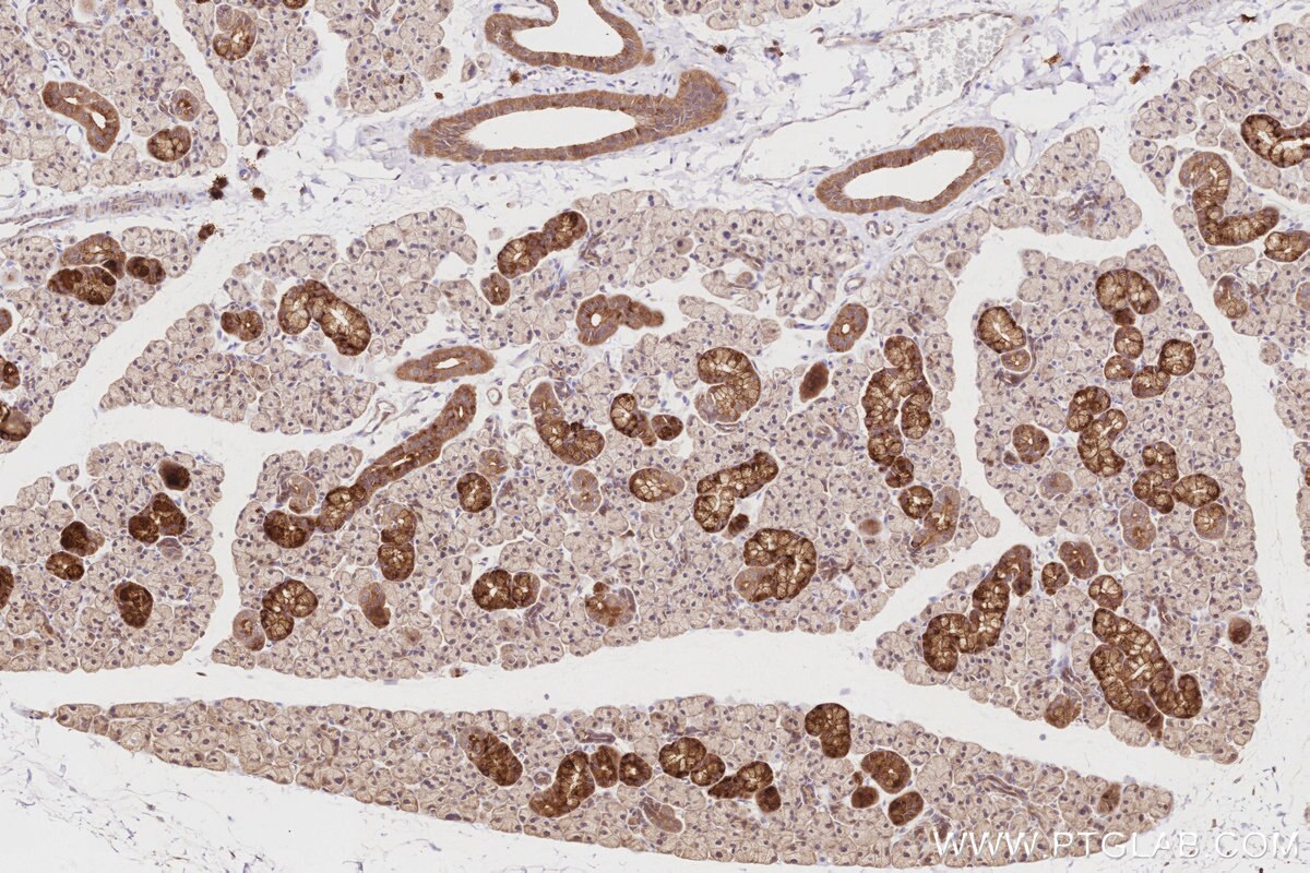 Immunohistochemistry (IHC) staining of rat salivary gland tissue using PKP4 Polyclonal antibody (14062-1-AP)