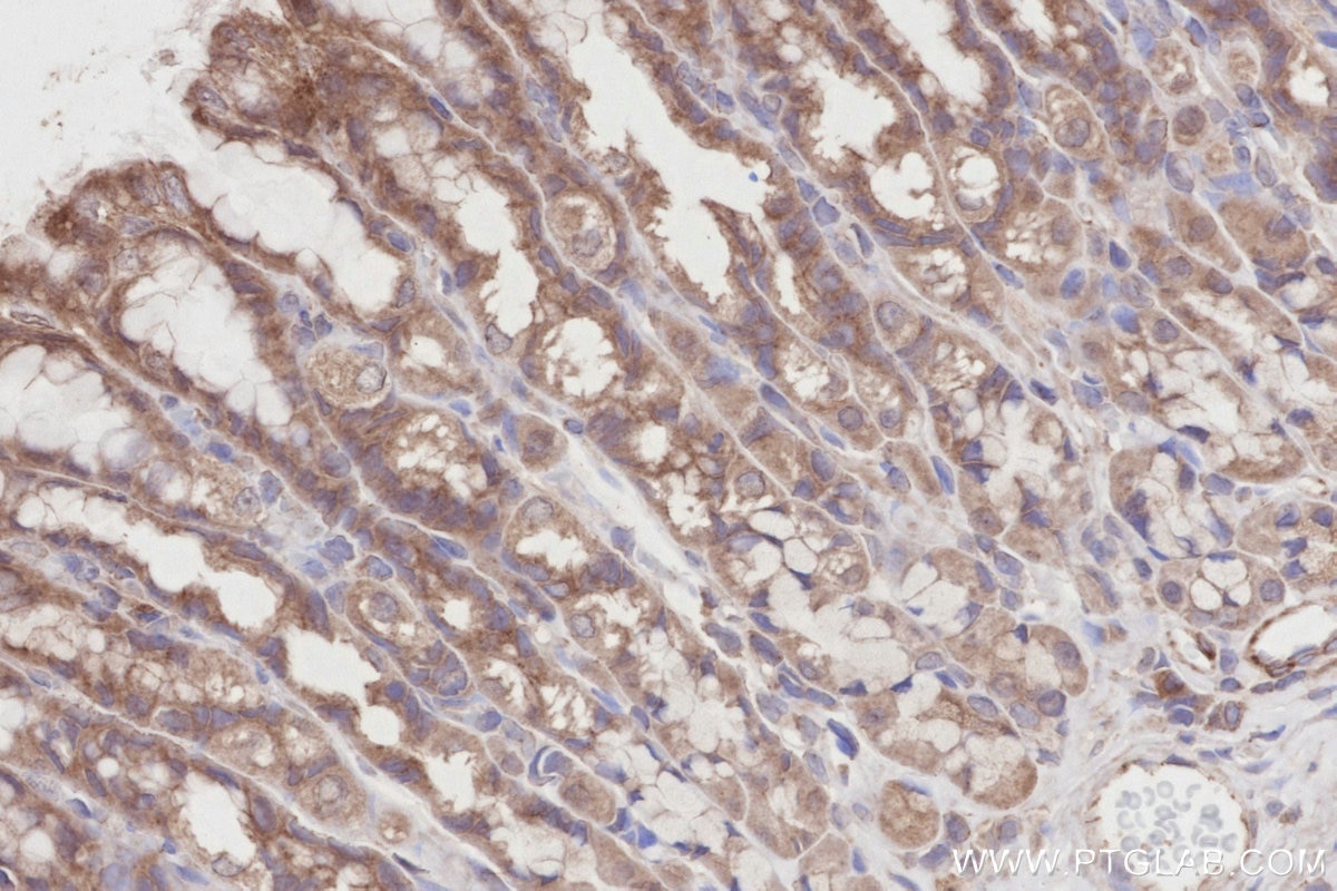 Immunohistochemistry (IHC) staining of rat stomach tissue using PKP4 Polyclonal antibody (14062-1-AP)