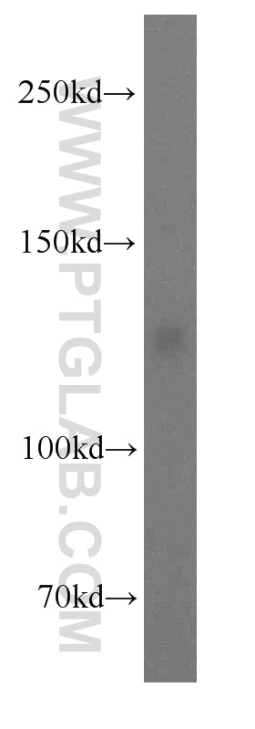 Western Blot (WB) analysis of HepG2 cells using PKP4 Polyclonal antibody (14062-1-AP)