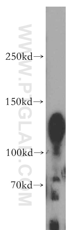 Western Blot (WB) analysis of A431 cells using PKP4 Polyclonal antibody (14062-1-AP)