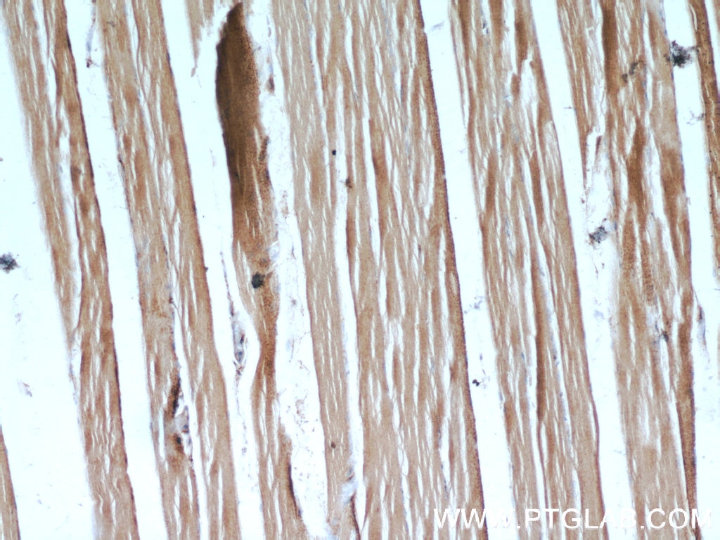 Immunohistochemistry (IHC) staining of human skeletal muscle tissue using PLA2G12A Polyclonal antibody (16009-1-AP)