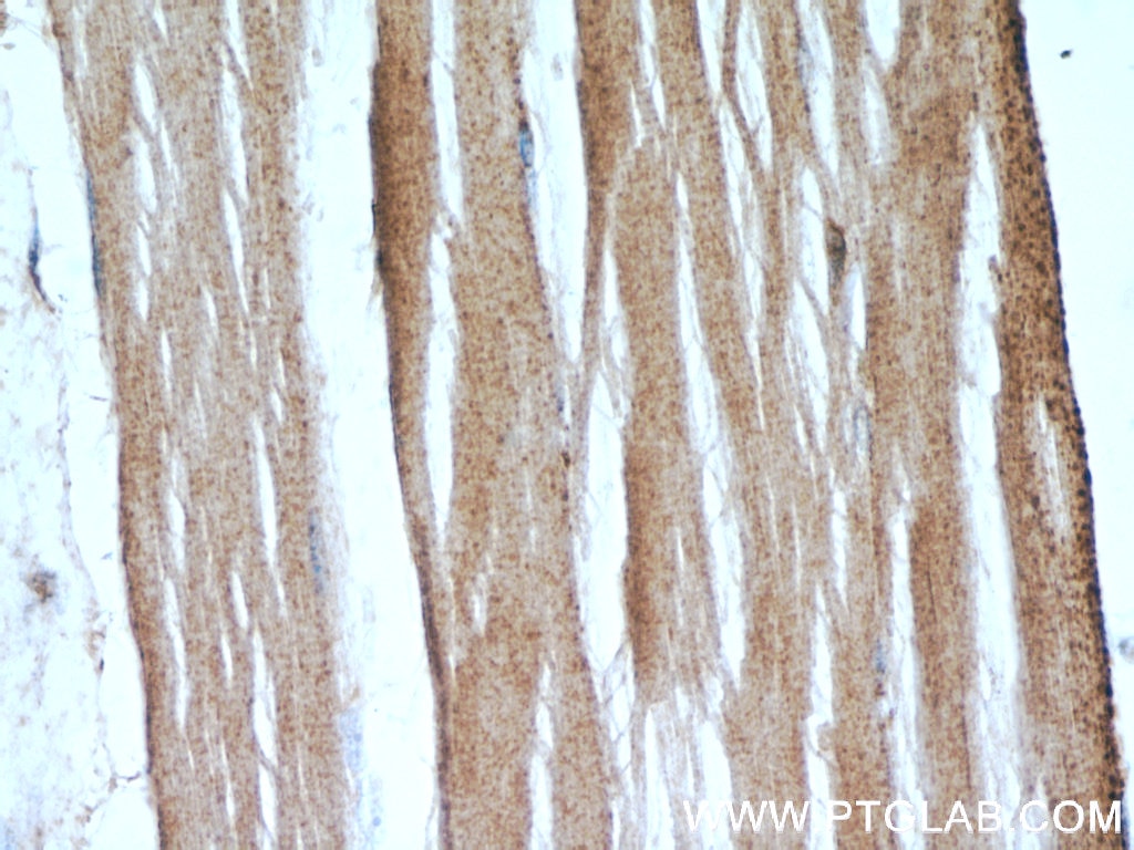 Immunohistochemistry (IHC) staining of human skeletal muscle tissue using PLA2G12A Polyclonal antibody (16009-1-AP)