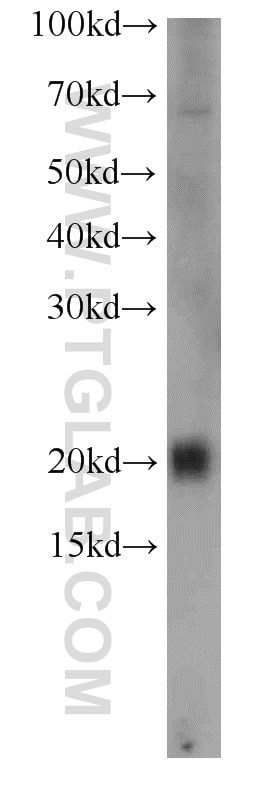 Western Blot (WB) analysis of HEK-293 cells using PLA2G12A Polyclonal antibody (16009-1-AP)