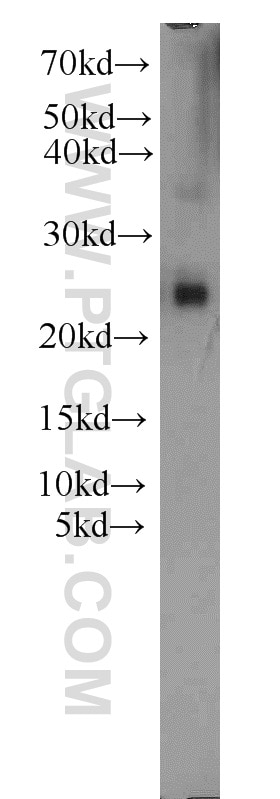 Western Blot (WB) analysis of mouse skeletal muscle tissue using PLA2G12A Polyclonal antibody (16009-1-AP)
