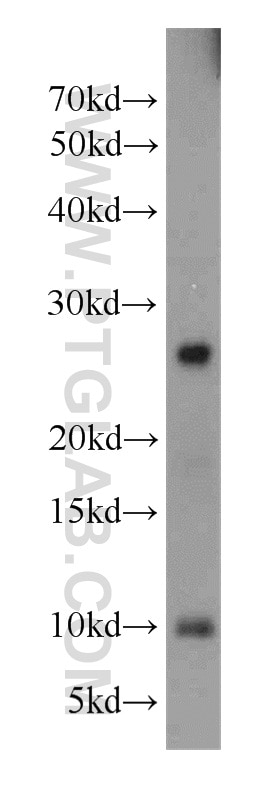 Western Blot (WB) analysis of mouse heart tissue using PLA2G12A Polyclonal antibody (16009-1-AP)