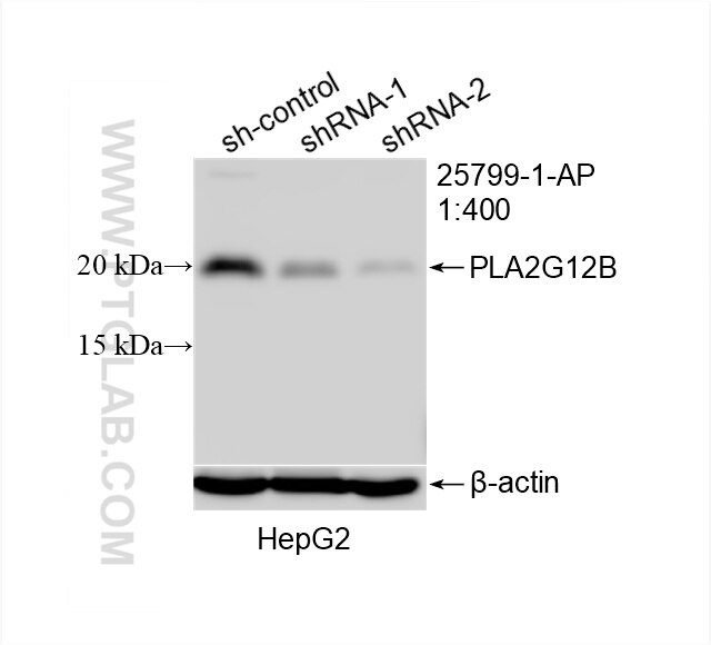 Western Blot (WB) analysis of HepG2 cells using PLA2G12B Polyclonal antibody (25799-1-AP)