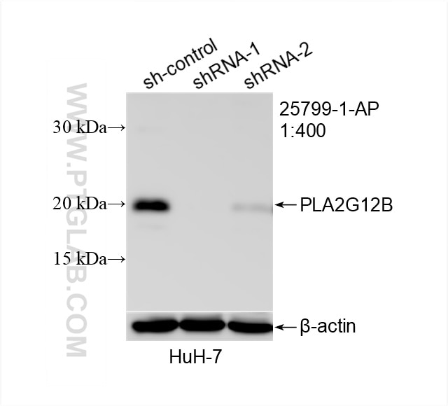 Western Blot (WB) analysis of HuH-7 cells using PLA2G12B Polyclonal antibody (25799-1-AP)