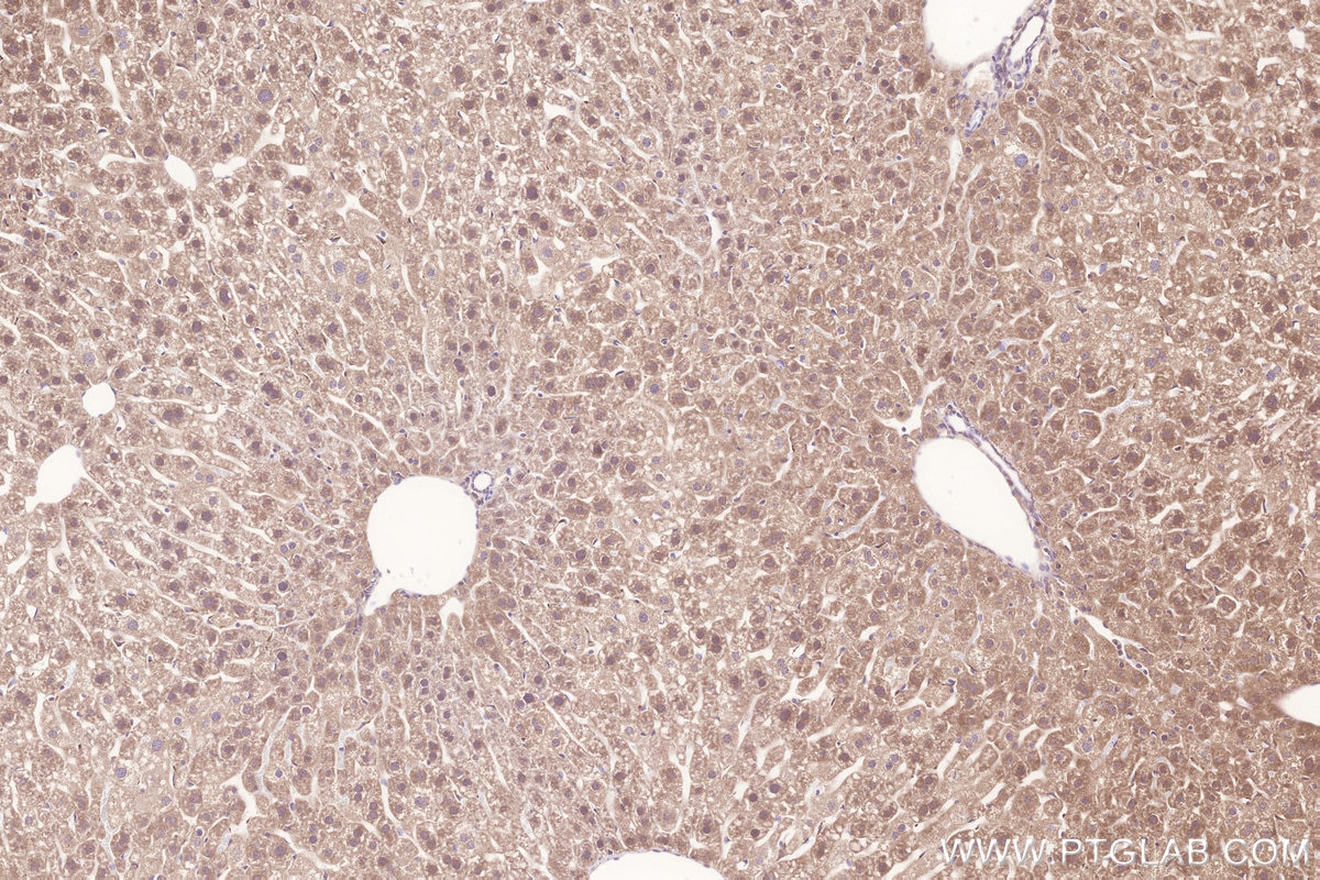 Immunohistochemistry (IHC) staining of mouse liver tissue using LYPLA3 Polyclonal antibody (10863-2-AP)