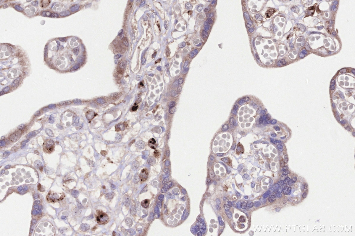 Immunohistochemistry (IHC) staining of human placenta tissue using LYPLA3 Polyclonal antibody (10863-2-AP)