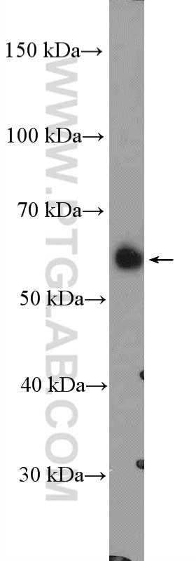 Western Blot (WB) analysis of mouse kidney tissue using LYPLA3 Polyclonal antibody (10863-2-AP)