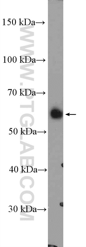 Western Blot (WB) analysis of mouse kidney tissue using LYPLA3 Polyclonal antibody (10863-2-AP)