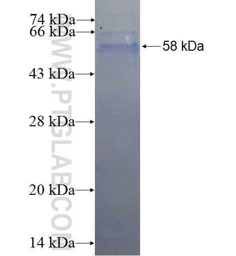 PLA2G15 fusion protein Ag1304 SDS-PAGE