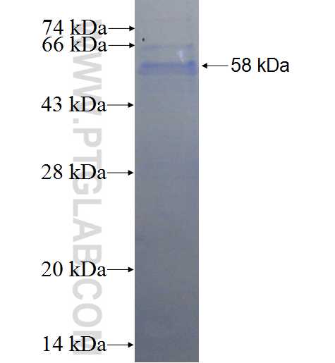 PLA2G15 fusion protein Ag1304 SDS-PAGE