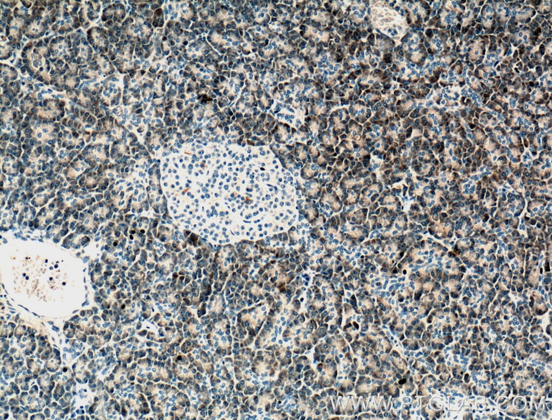 Immunohistochemistry (IHC) staining of human pancreas tissue using PLA2G1B Monoclonal antibody (66397-1-Ig)