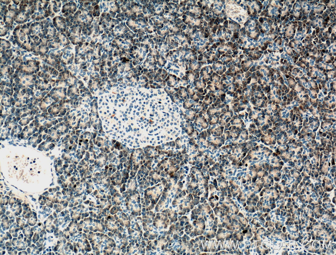 IHC staining of human pancreas using 66397-1-Ig