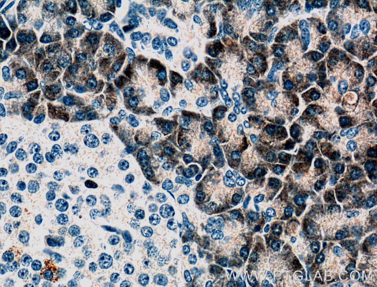 Immunohistochemistry (IHC) staining of human pancreas tissue using PLA2G1B Monoclonal antibody (66397-1-Ig)