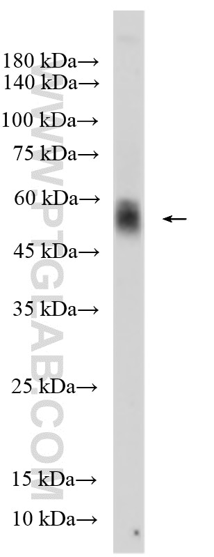 Western Blot (WB) analysis of various lysates using PLA2G3 Polyclonal antibody (17646-1-AP)