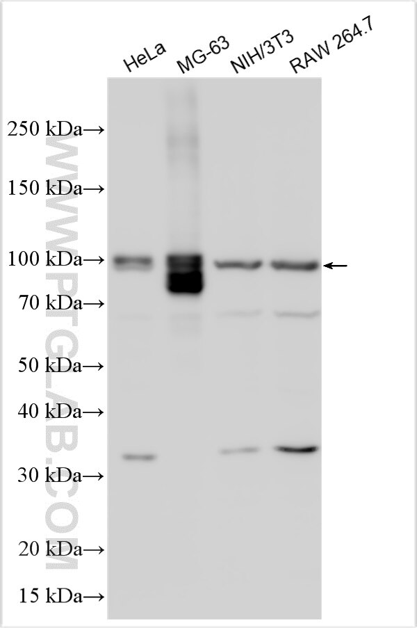 Western Blot (WB) analysis of various lysates using PLA2G4A Polyclonal antibody (21004-1-AP)