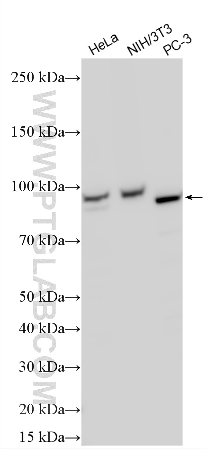 WB analysis using 21004-1-AP Western Blot (WB) analysis of various lysates using PLA2G4A Polyclonal antibody (21004-1-AP)