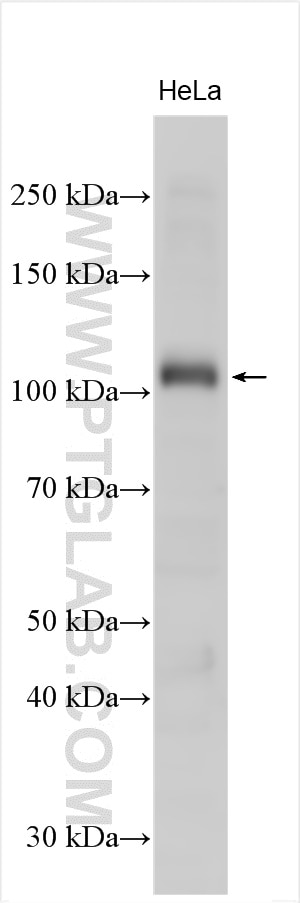 Western Blot (WB) analysis of various lysates using PLA2G4A Polyclonal antibody (28924-1-AP)