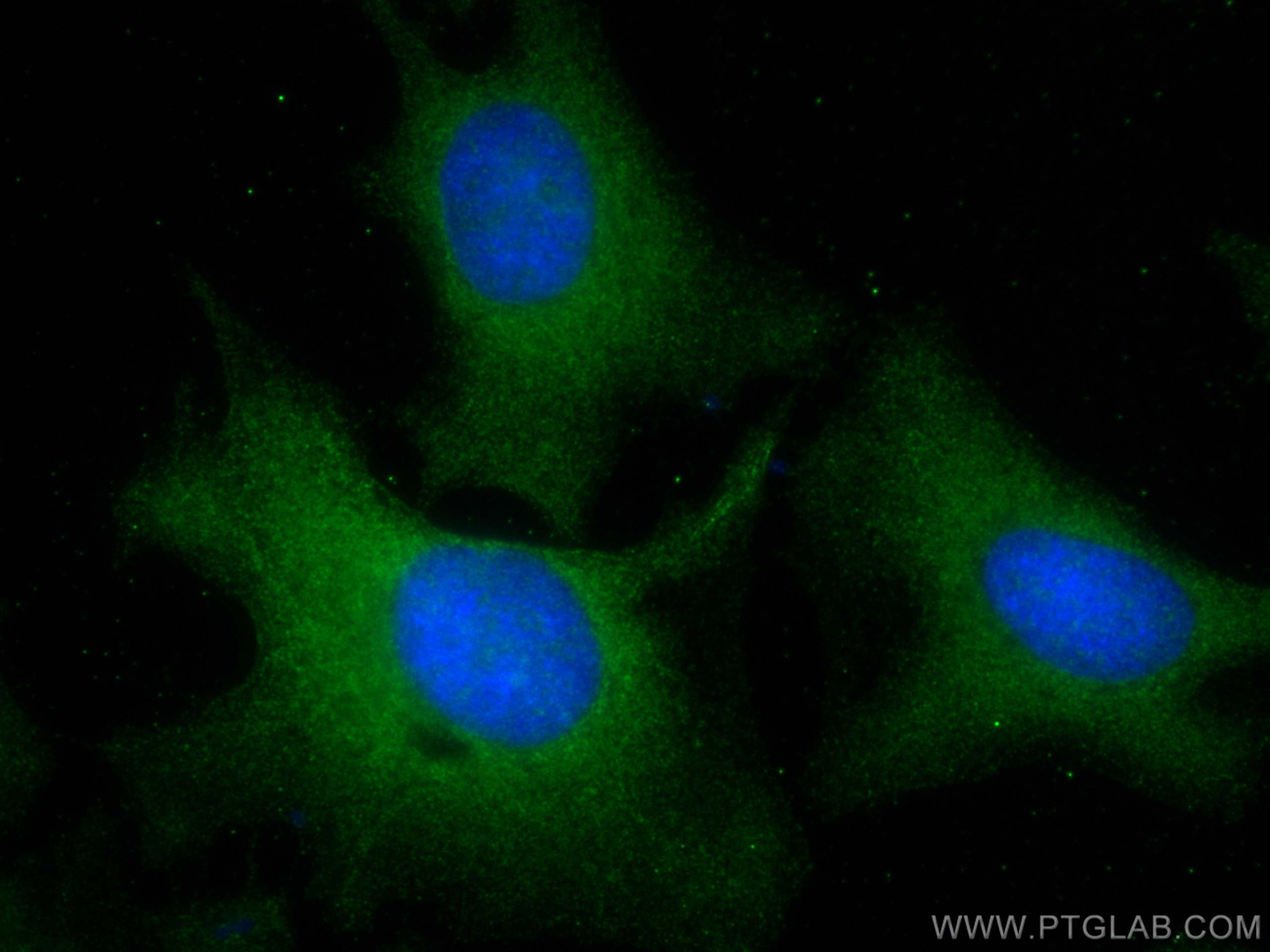 Immunofluorescence (IF) / fluorescent staining of HeLa cells using PLA2G4A Monoclonal antibody (68133-1-Ig)