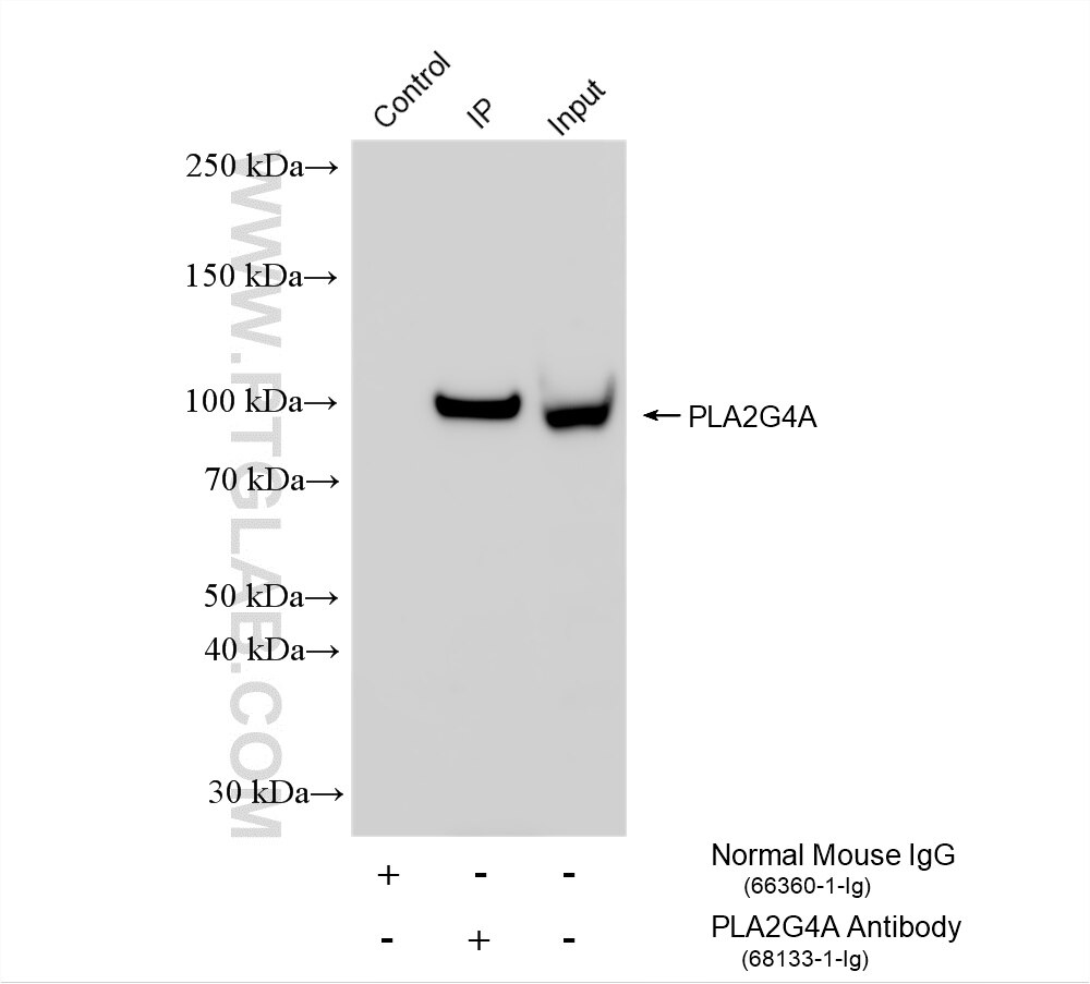 IP experiment of HeLa using 68133-1-Ig Immunoprecipitation (IP) experiment of HeLa cells using PLA2G4A Monoclonal antibody (68133-1-Ig)