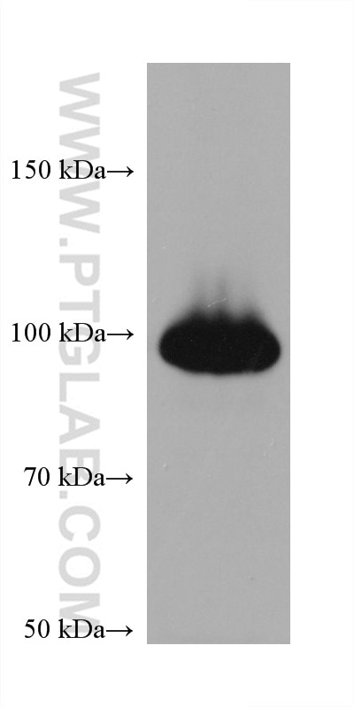Western Blot (WB) analysis of HeLa cells using PLA2G4A Monoclonal antibody (68133-1-Ig)