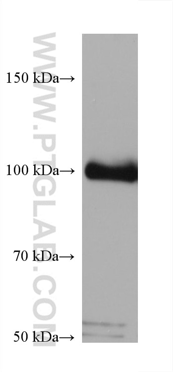 Western Blot (WB) analysis of A549 cells using PLA2G4A Monoclonal antibody (68133-1-Ig)