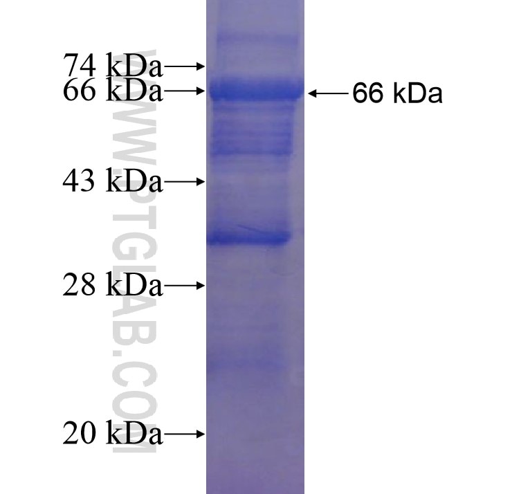PLA2G4A fusion protein Ag15202 SDS-PAGE