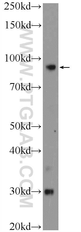 Western Blot (WB) analysis of human plasma using PLA2G4B Polyclonal antibody (55074-1-AP)