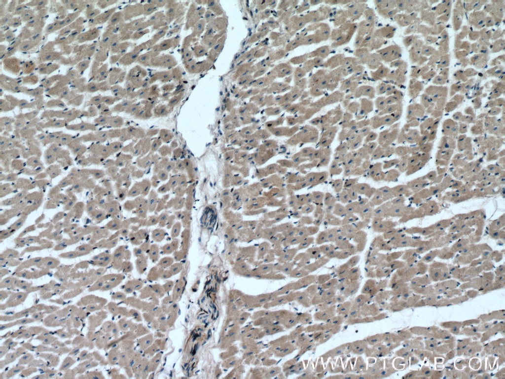 Immunohistochemistry (IHC) staining of human heart tissue using PLA2G4C Polyclonal antibody (14904-1-AP)