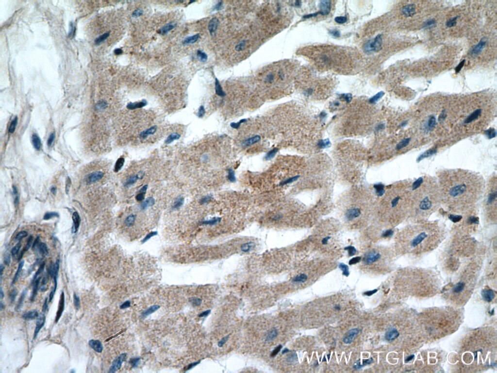 Immunohistochemistry (IHC) staining of human heart tissue using PLA2G4C Polyclonal antibody (14904-1-AP)