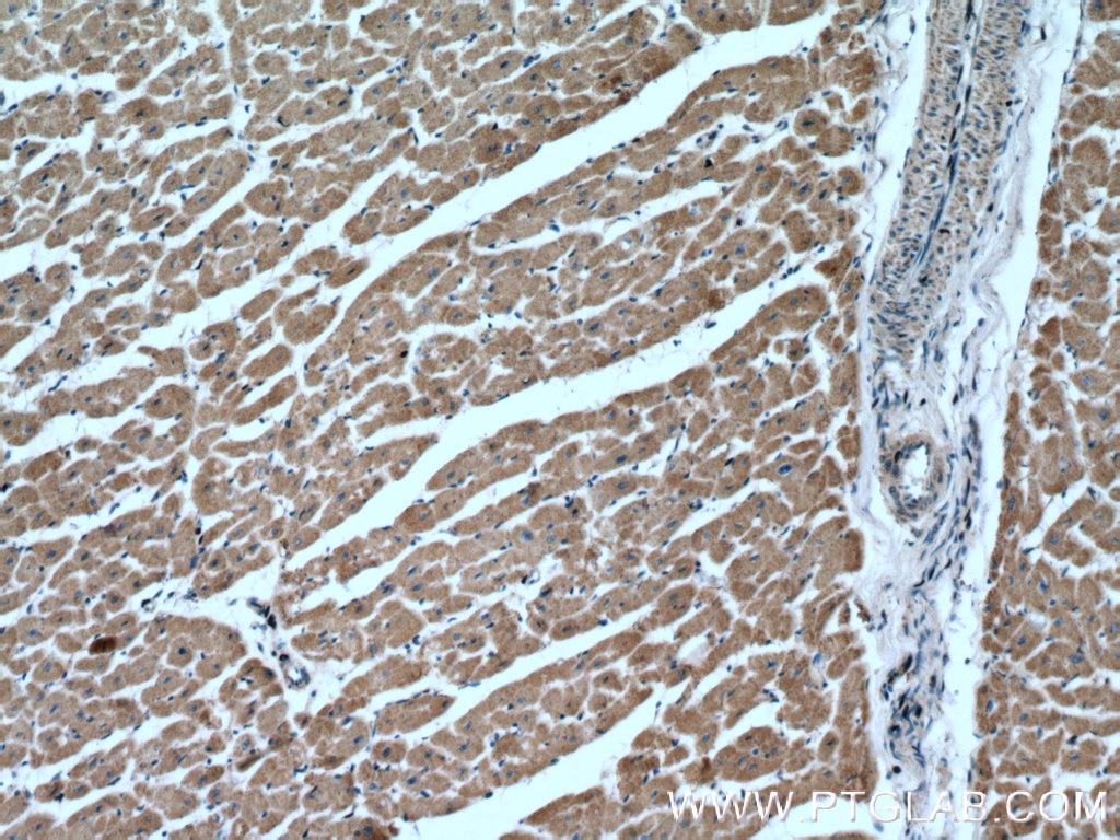 Immunohistochemistry (IHC) staining of human heart tissue using PLA2G4C Polyclonal antibody (14904-1-AP)