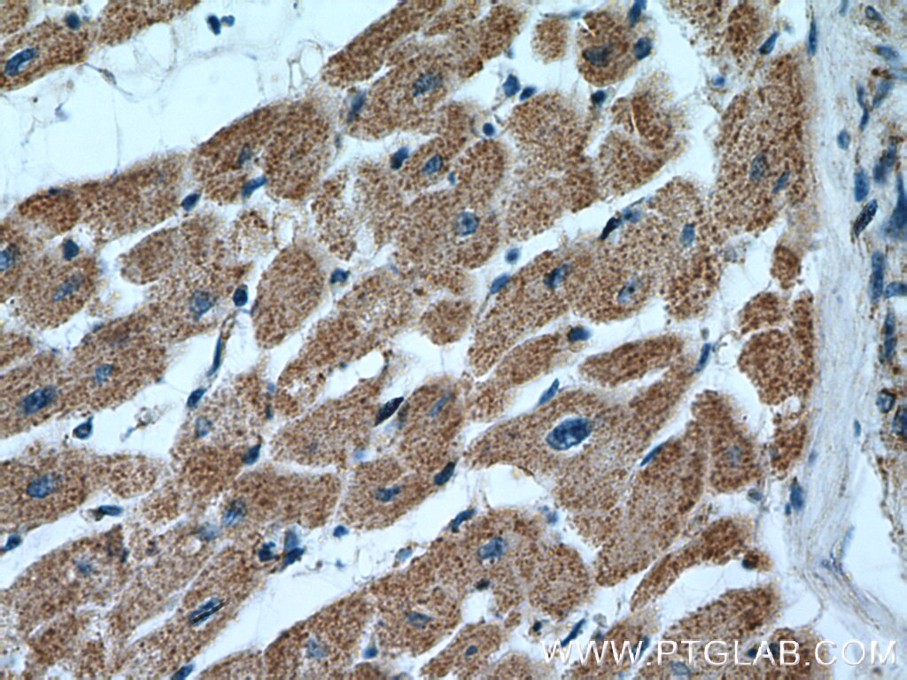 Immunohistochemistry (IHC) staining of human heart tissue using PLA2G4C Polyclonal antibody (14904-1-AP)