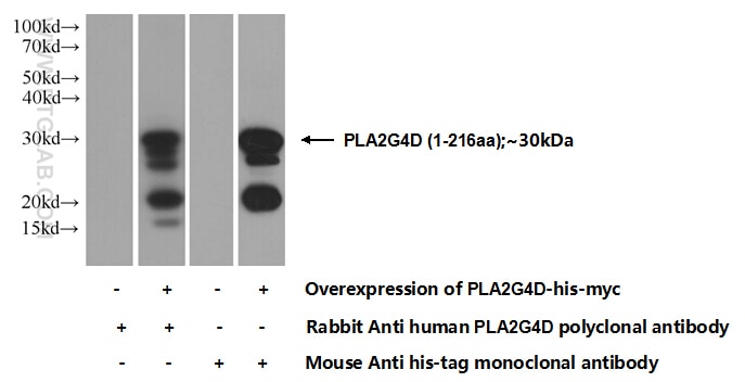 Western Blot (WB) analysis of Transfected HEK-293 cells using PLA2G4D Polyclonal antibody (13345-1-AP)