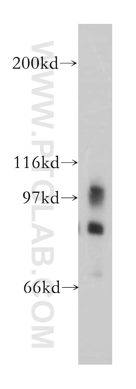 Western Blot (WB) analysis of mouse brain tissue using PLA2G4D Polyclonal antibody (13345-1-AP)