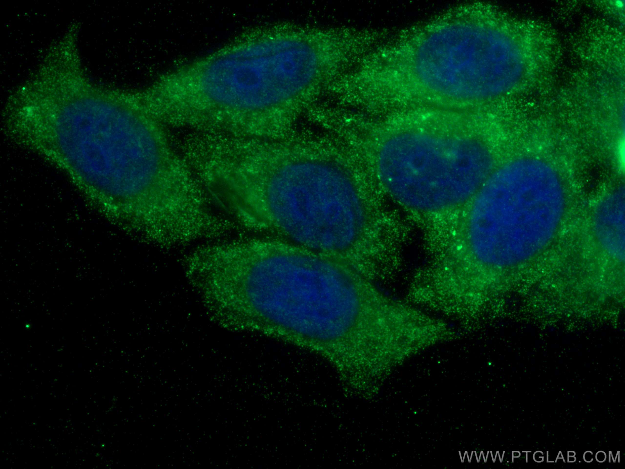 Immunofluorescence (IF) / fluorescent staining of HepG2 cells using PLA2G4D Monoclonal antibody (66752-1-Ig)