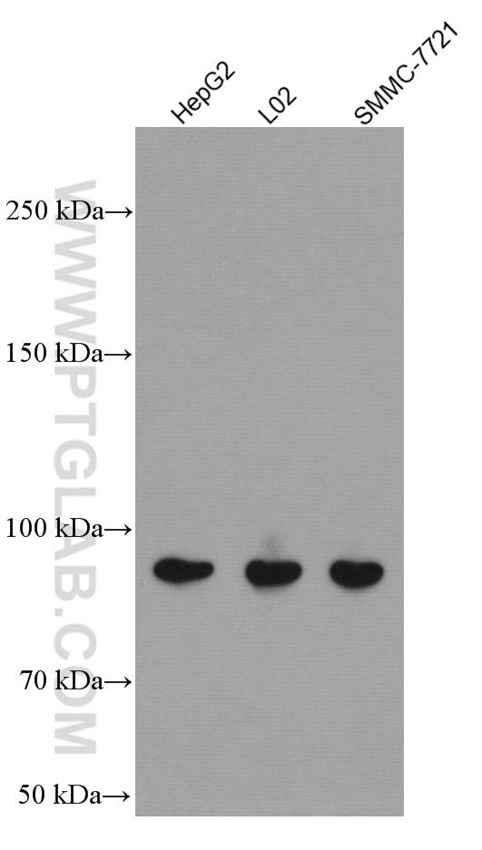 Western Blot (WB) analysis of various lysates using PLA2G4D Monoclonal antibody (66752-1-Ig)