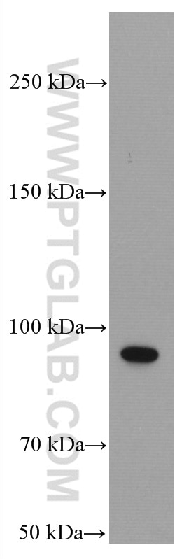 Western Blot (WB) analysis of Caco-2 cells using PLA2G4D Monoclonal antibody (66752-1-Ig)